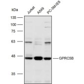 Solarbio K110321P Anti-GPRC5B Polyclonal Antibody
