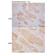 Solarbio K110081P Anti-CYB5R1 Polyclonal Antibody