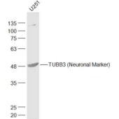 Solarbio K009636P Anti-TUBB3 Polyclonal Antibody
