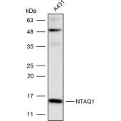 Solarbio K110487P Anti-NTAQ1 Polyclonal Antibody