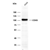 Solarbio K001742P Anti-CDH5 Polyclonal Antibody