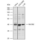 Solarbio K110467P Anti-NUCB2 Polyclonal Antibody