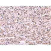 Solarbio K009854P Anti-GSTCD Polyclonal Antibody