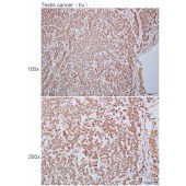 Solarbio K112296P Anti-EIF4B Polyclonal Antibody