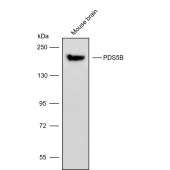 Solarbio K009797P Anti-PDS5B Polyclonal Antibody