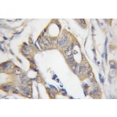 Solarbio K009782P Anti-CHRNB1 Polyclonal Antibody