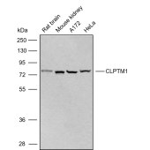 Solarbio K009831P Anti-CLPTM1 Polyclonal Antibody