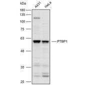 Solarbio K110480P Anti-PTBP1 Polyclonal Antibody