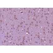 Solarbio K009774P Anti-CGRP-I/II Polyclonal Antibody