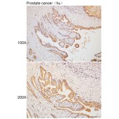 Solarbio K110333P Anti-VAPB Polyclonal Antibody