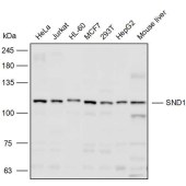 Solarbio K110353P Anti-SND1 Polyclonal Antibody