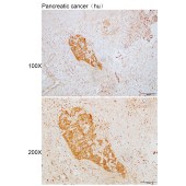 Solarbio K110119P Anti-VCL Polyclonal Antibody