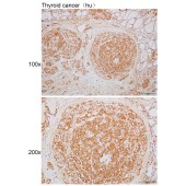 Solarbio K110390P Anti-RIMBP3 Polyclonal Antibody