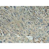 Solarbio K009842P Anti-RPL10L Polyclonal Antibody