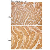 Solarbio K110487P Anti-NTAQ1 Polyclonal Antibody