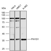 Solarbio K112283P Anti-PIH1D1 Polyclonal Antibody