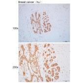 Solarbio K110464P Anti-MATR3 Polyclonal Antibody