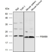 Solarbio K110281P Anti-PSMB9 Polyclonal Antibody
