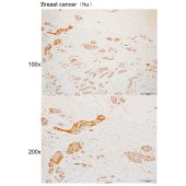 Solarbio K110056P Anti-NUAK2 Polyclonal Antibody