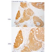 Solarbio K112281P Anti-CHMP5 Polyclonal Antibody