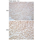 Solarbio K112429P Anti-PCDHB10 Polyclonal Antibody