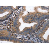 Solarbio K009877P Anti-DPYSL4 Polyclonal Antibody