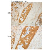 Solarbio K112247P Anti-BCS1L Polyclonal Antibody