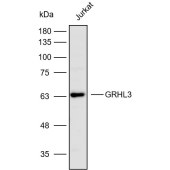 Solarbio K112432P Anti-GRHL3 Polyclonal Antibody