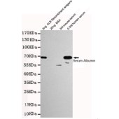 Solarbio K001370M Anti-ALB Monoclonal Antibody