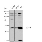 Solarbio K112231P Anti-SURF1 Polyclonal Antibody