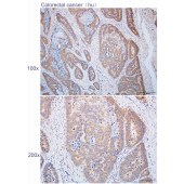 Solarbio K112208P Anti-ARHGEF11 Polyclonal Antibody