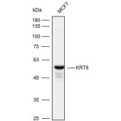 Solarbio K109959P Anti-KRT8 Polyclonal Antibody