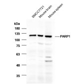 Solarbio K001766P Anti-PARP Polyclonal Antibody