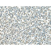 Solarbio K009852P Anti-ATP6V1C1 Polyclonal Antibody