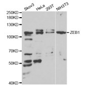 Solarbio K004076P Anti-ZEB1 Rabbit Polyclonal Antibody