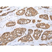 Solarbio K009811P Anti-FMO5 Polyclonal Antibody