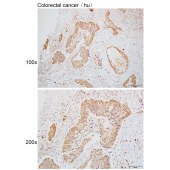 Solarbio K110093P Anti-CDK17 Polyclonal Antibody
