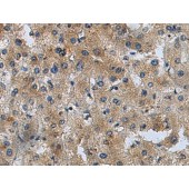Solarbio K009830P Anti-CHST10 Polyclonal Antibody