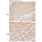 Solarbio K110126P Anti-DENND1A Polyclonal Antibody