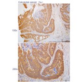Solarbio K112293P Anti-PRKAG2 Polyclonal Antibody
