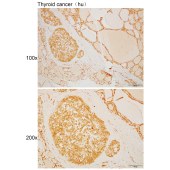Solarbio K110513P Anti-POLR3K Polyclonal Antibody