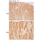 Solarbio K110409P Anti-BCAT1 Polyclonal Antibody