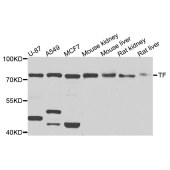 Solarbio K002787P Anti-TF Polyclonal Antibody