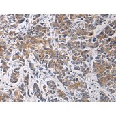 Solarbio K009864P Anti-TMOD3 Polyclonal Antibody