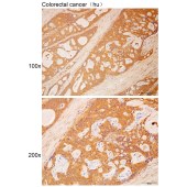 Solarbio K112195P Anti-COL4A5 Polyclonal Antibody