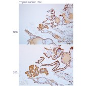 Solarbio K112300P Anti-LCMT1 Polyclonal Antibody