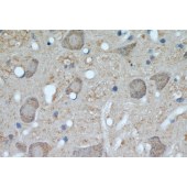 Solarbio K009775P Anti-UCP1 Polyclonal Antibody
