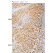 Solarbio K110500P Anti-ZBTB24 Polyclonal Antibody