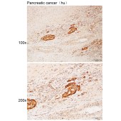 Solarbio K112202P Anti-GRIN2A/B Polyclonal Antibody