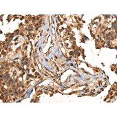 Solarbio K009825P Anti-CAMKK1 Polyclonal Antibody